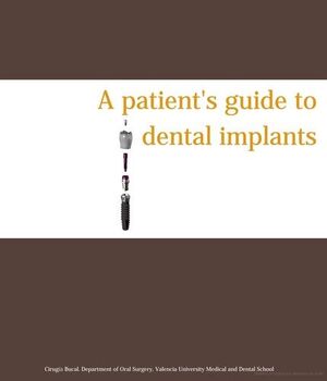 A PATIENT'S GUIDE TO DENTAL IMPLANTS