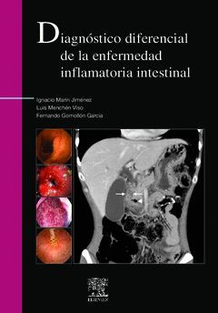 DIAGNOSTICO DIFERENCIAL DE LA ENFERMEDAD INFLAMATORIA INTESTINAL
