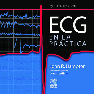 ECG EN LA PRACTICA