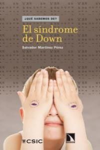 SÍNDROME DE DOWN, EL.QUE SABEMOS DE.CATARATA-CSIC.RUST