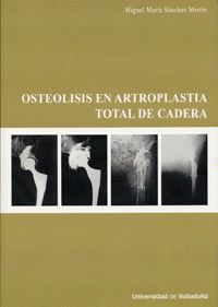 OSTEOLISIS EN ARTROPLASTIA TOTAL DE CADERA