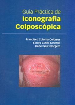 GUÍA PRÁCTICA DE ICONOGRAFÍA COLPOSCÓPICA