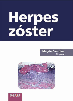 HERPES ZOSTER. MARGE-MEDICA-DURA
