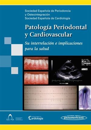 PATOLOGIA PERIODONTAL Y CARDIOVASCULAR
