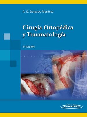 CIRUGIA ORTOPEDICA Y TRAUMATOLOGIA