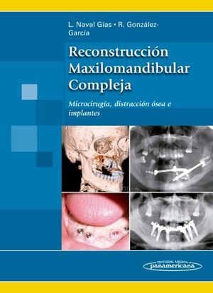 RECONSTRUCCION MAXILOMANDIBULAR COMPLEJA
